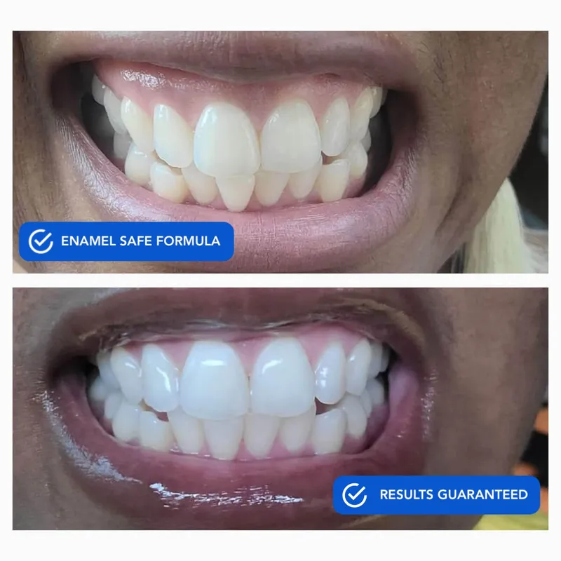 Fitas Clareadoras Dissolvíveis SNOW Diamond Series