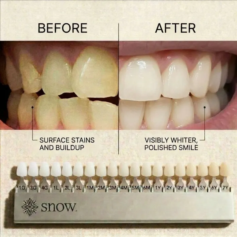 Pó Clareador SNOW Purple com Hidroxiapatita