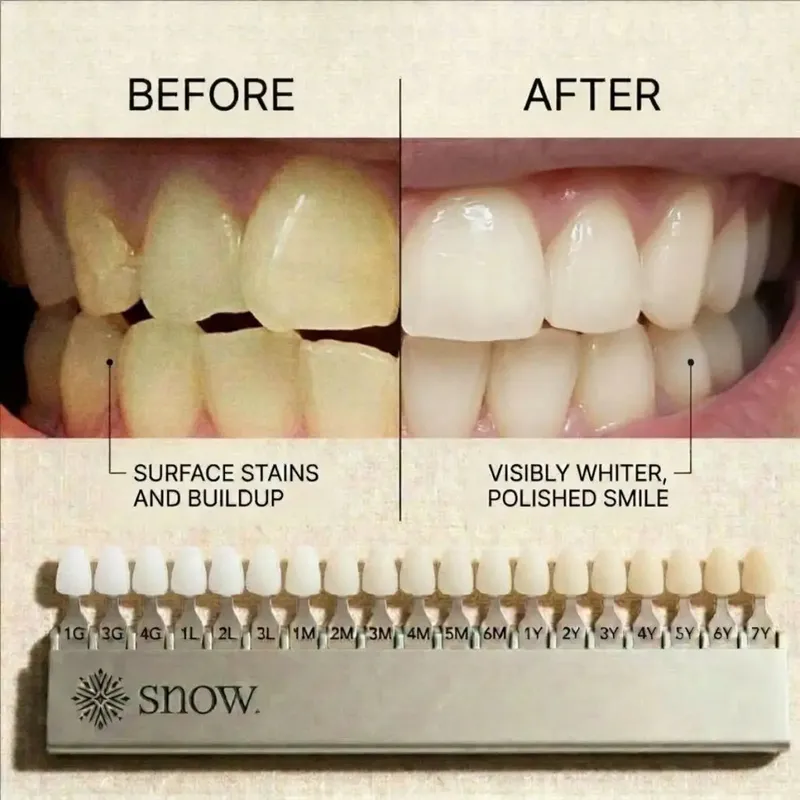 Pó Clareador SNOW Magic Powder com Hidroxiapatita